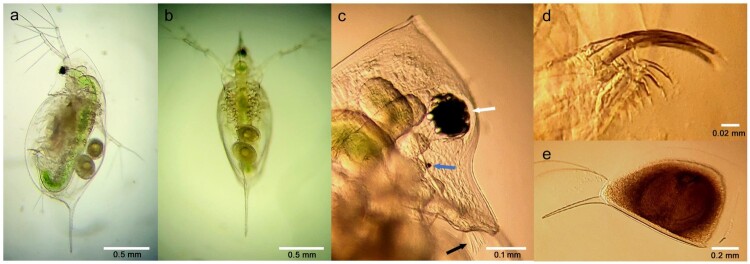 Dietary exposure of the water flea <i>Daphnia galeata</i> to microcystin-LR.