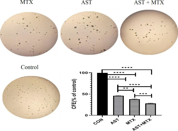 Astaxanthin Co-treatment with Low Dose Methotrexate Increases the Cell Cycle Arrest and Ameliorates the Methotrexate-induced Inflammatory Response in NALM-6.