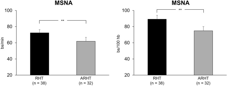 Renal Denervation in End-Stage Renal Disease: Current Evidence and Perspectives.