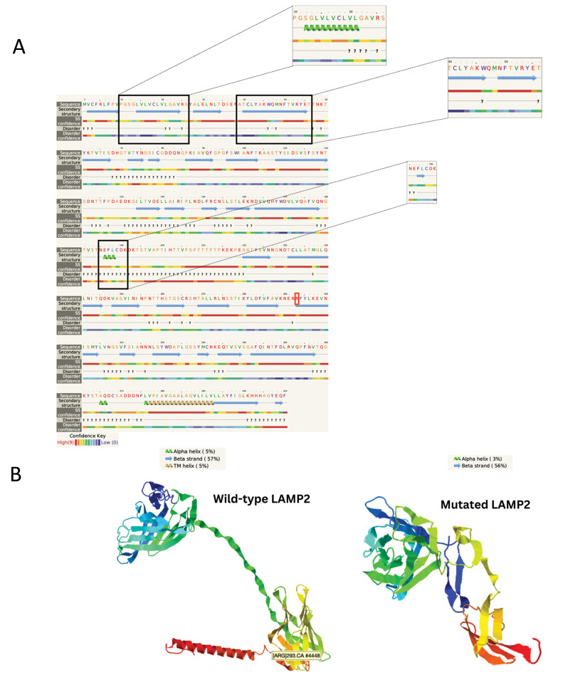 A Mutational Hotspot in The <i>LAMP2</i> Gene: Unravelling Intrafamilial Phenotypic Variation and Global Distribution of The c.877C>T Variant: A Descriptive Study.