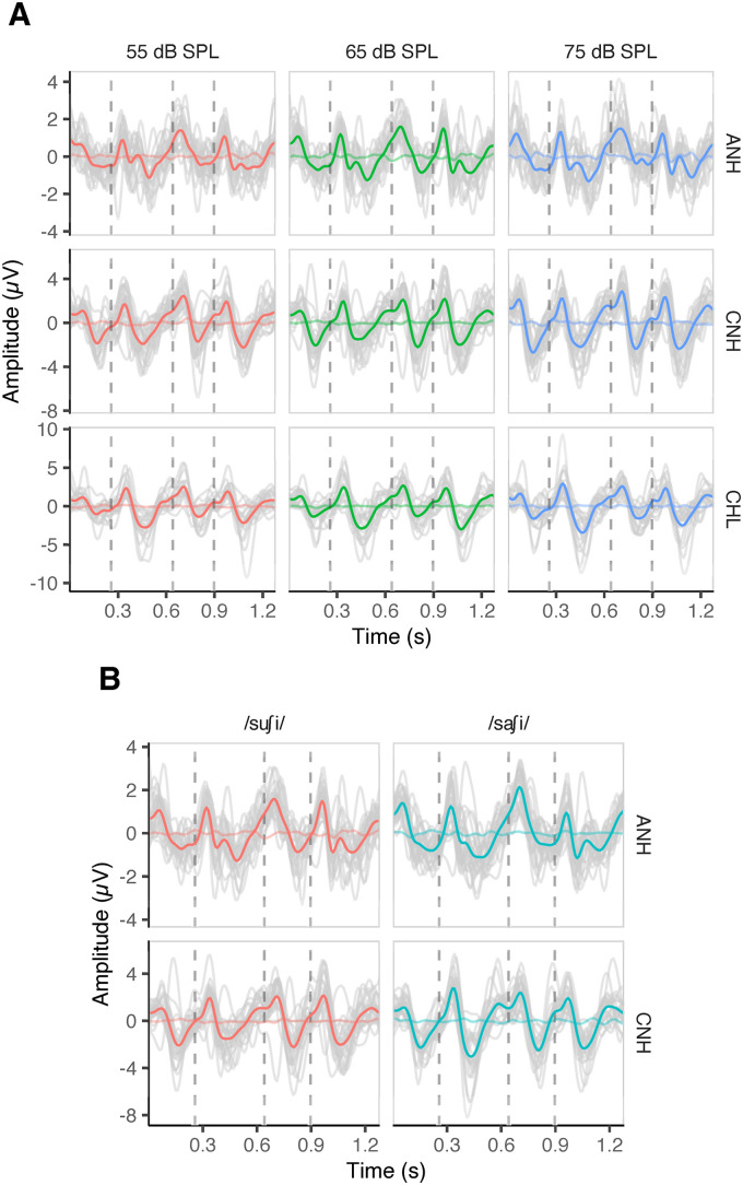 Assessing Speech Audibility via Syllabic-Rate Neural Responses in Adults and Children With and Without Hearing Loss.