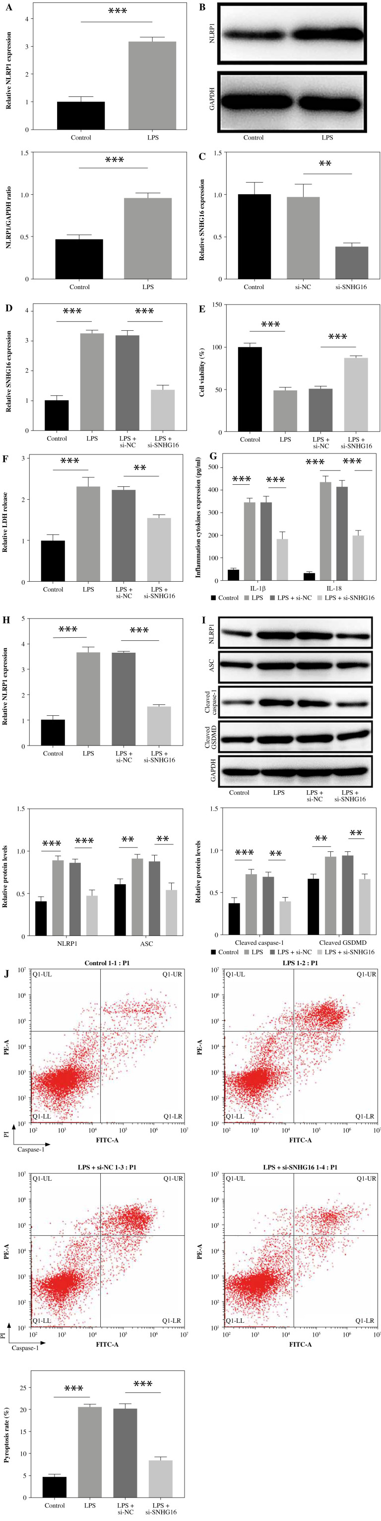 LncRNA SNHG16 promotes LPS-induced human bronchial epithelial cell pyroptosis through miR-339-5p/NLRP1 axis mediation.