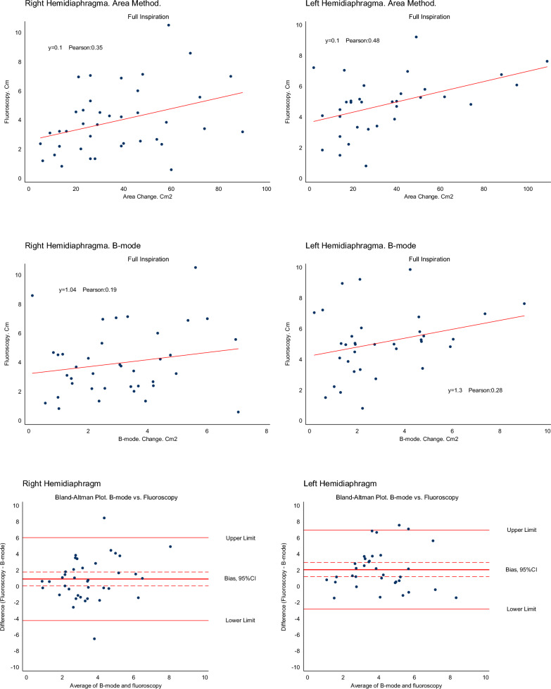 Replacement of fluoroscopy by ultrasonography in the evaluation of hemidiaphragm function, an exploratory prospective study.