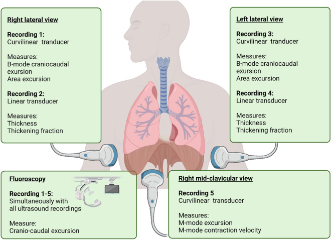 Replacement of fluoroscopy by ultrasonography in the evaluation of hemidiaphragm function, an exploratory prospective study.