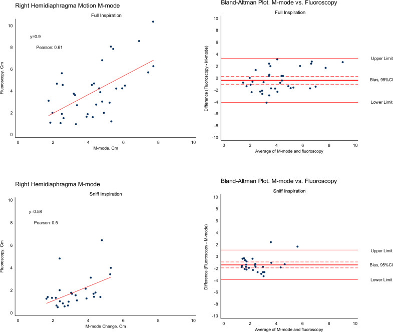 Replacement of fluoroscopy by ultrasonography in the evaluation of hemidiaphragm function, an exploratory prospective study.