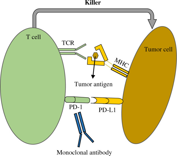 An updated review of immunotherapy in esophageal cancer: PD-L1 footprint.