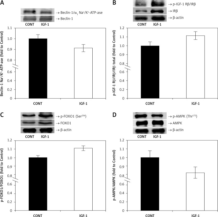 Insulin-like growth factor-1 reduces cardiac autosis through decreasing AMPK/FOXO1 signaling and Na<sup>+</sup>/K<sup>+</sup>-ATPase-Beclin-1 interaction.