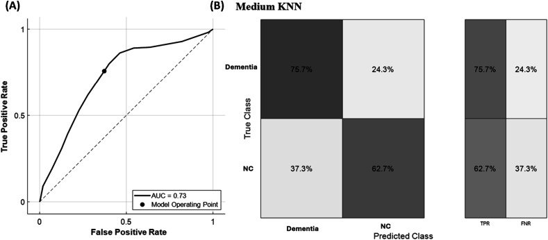 A Study on Machine Learning Models in Detecting Cognitive Impairments in Alzheimer's Patients Using Cerebrospinal Fluid Biomarkers.
