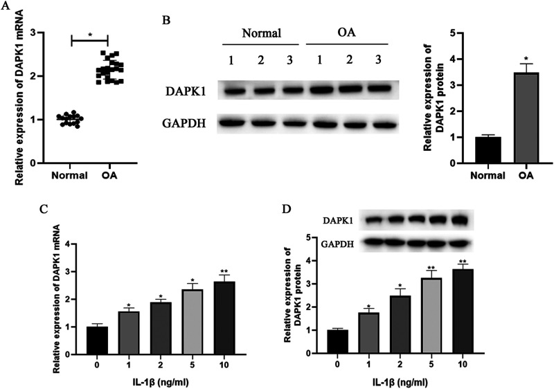 Knockdown of DAPK1 inhibits IL-1β-induced inflammation and cartilage degradation in human chondrocytes by modulating the PEDF-mediated NF-κB and NLRP3 inflammasome pathway.