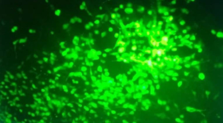 The investigation of the death-inducing potency of a recombinant Adenovector expressing Mda-7-tlyp-1 on different cancer cell lines.