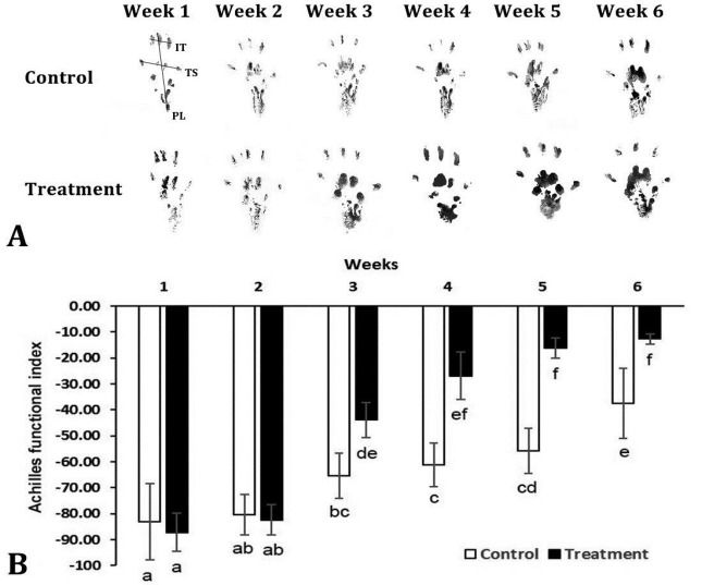 Effect of curcumin-loaded polycaprolactone scaffold on Achilles tendon repair in rats.