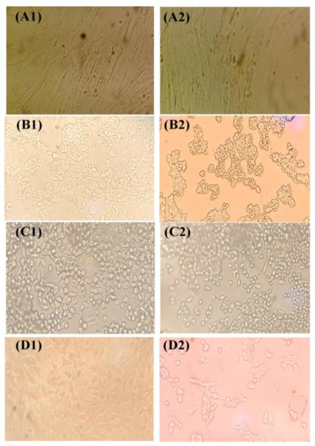 The investigation of the death-inducing potency of a recombinant Adenovector expressing Mda-7-tlyp-1 on different cancer cell lines.