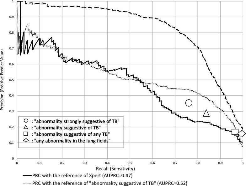 Applicability of artificial intelligence-based computer-aided detection (AI-CAD) for pulmonary tuberculosis to community-based active case finding.