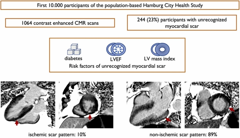 Unrecognized myocardial scar by late-gadolinium-enhancement cardiovascular magnetic resonance: Insights from the population-based Hamburg City Health Study.