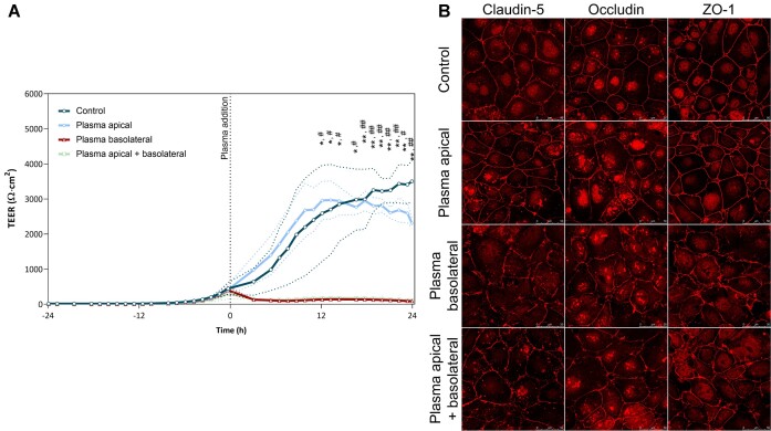 Plasma of COVID-19 Patients Does Not Alter Electrical Resistance of Human Endothelial Blood-Brain Barrier In Vitro.