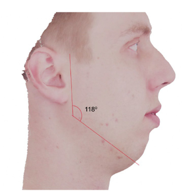 An Open Source Framework for Free Precise Digital Facial Analysis.