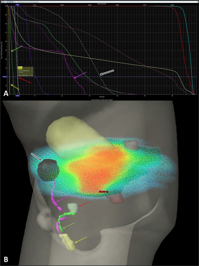 Optimizing functional outcomes in prostate cancer: a new perspective on early artificial urinary sphincter implantation before salvage radiotherapy in prostate cancer treatment.