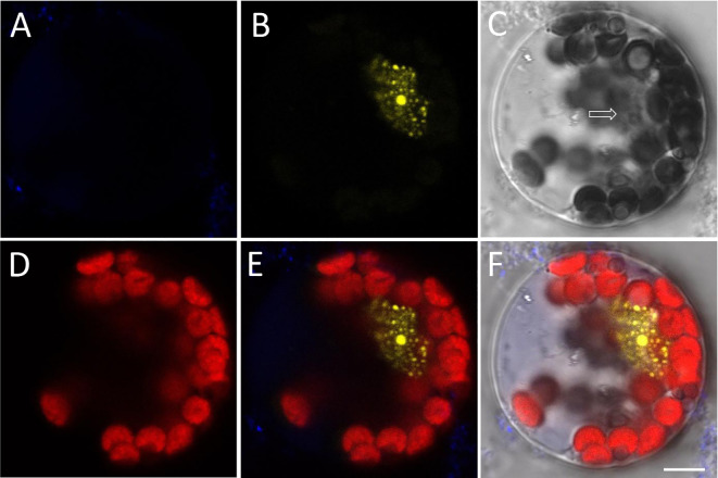An optimum study on the laser scanning confocal microscopy techniques for BiFC assay using plant protoplast.