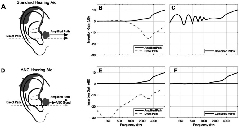 Modeling the Intelligibility Benefit of Active Noise Cancelation in Hearing Devices That Improve Signal-to-Noise Ratio.