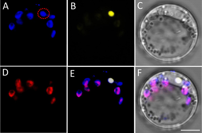 An optimum study on the laser scanning confocal microscopy techniques for BiFC assay using plant protoplast.