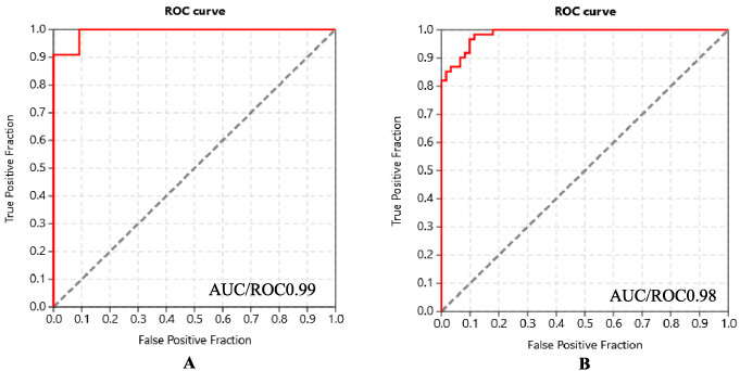 In-silico prediction of anti-breast cancer activity of ginger (Zingiber officinale) using machine learning techniques.