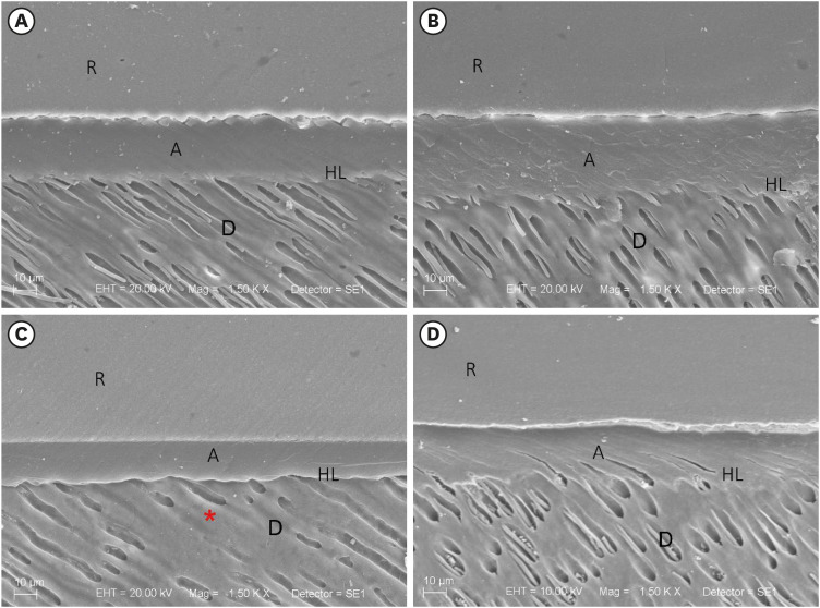 Pomegranate extract on eroded dentin: antioxidant action, bond strength and morphology of the adhesive interface after aging.