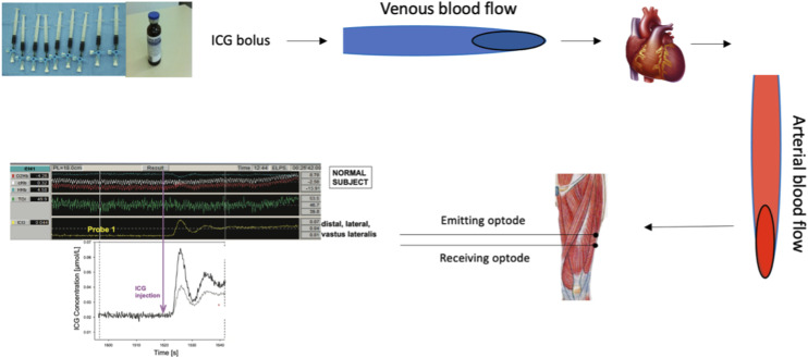 Respiratory and locomotor muscle blood flow measurements using near-infrared spectroscopy and indocyanine green dye in health and disease.