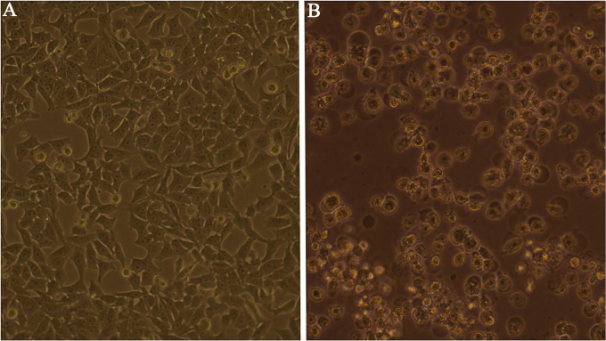 Respiratory virus infections and adenovirus characteristics during acute exacerbation of chronic obstructive pulmonary disease.