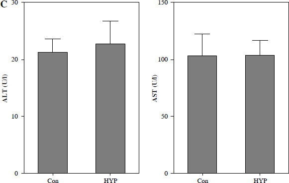 Preventive effect of hyperforin on lipopolysaccharide-induced acute kidney injury and inflammation by repressing the NF-κB/miR-21 axis.