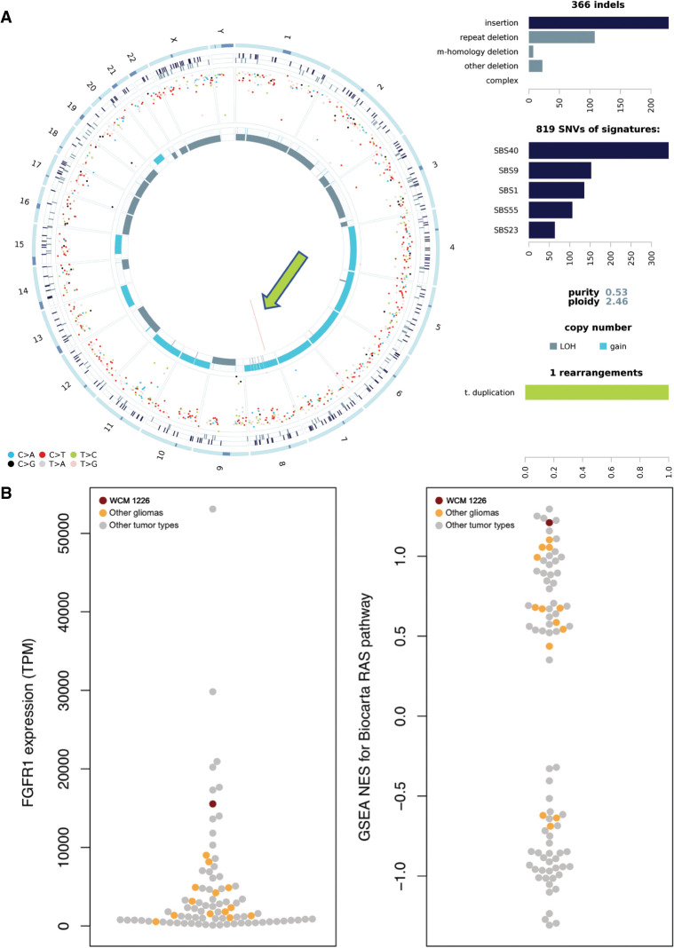 The importance of escalating molecular diagnostics in patients with low-grade pediatric brain cancer.