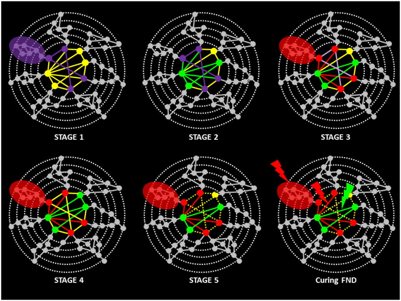 A global neuronal workspace model of functional neurological disorders.