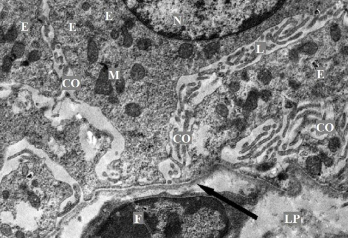 Ultra-structural organization of the gallbladder mucous membrane of Anglo-Nubian goat.