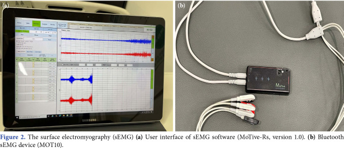 Effect of diaphragmatic breathing training with visual biofeedback on respiratory function in patients with multiple rib fractures: A randomized-controlled study.