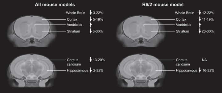 Magnetic Resonance Imaging to Detect Structural Brain Changes in Huntington's Disease: A Review of Data from Mouse Models.