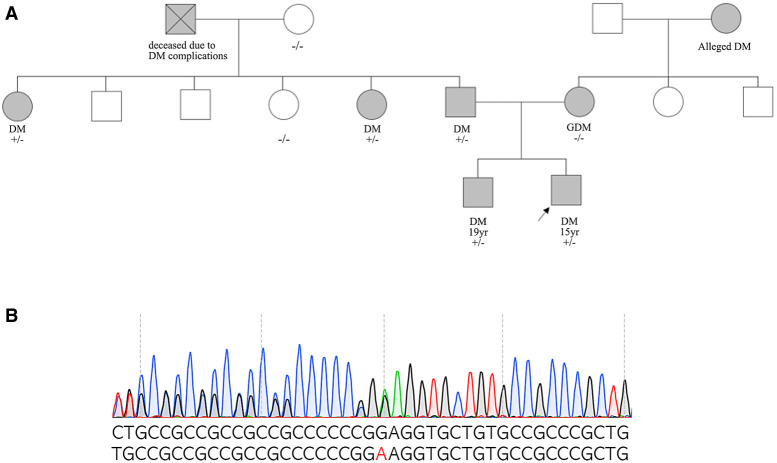 Novel pathogenic <i>PDX1</i> gene variant in a Korean family with maturity-onset diabetes of the young.