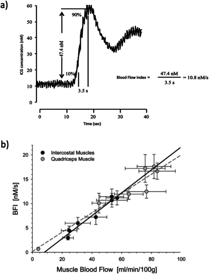 Respiratory and locomotor muscle blood flow measurements using near-infrared spectroscopy and indocyanine green dye in health and disease.