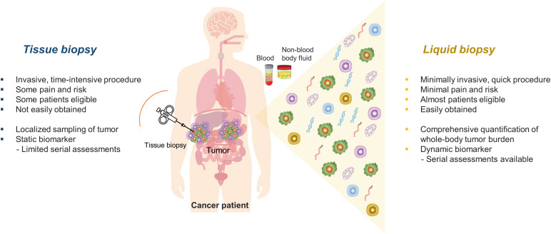 Liquid Biopsy: An Emerging Diagnostic, Prognostic, and Predictive Tool in Gastric Cancer.