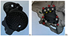 Does the interface between individual 3D acetabular implants and host bone influence the functional outcomes in patients with severe bone loss after revision surgery?