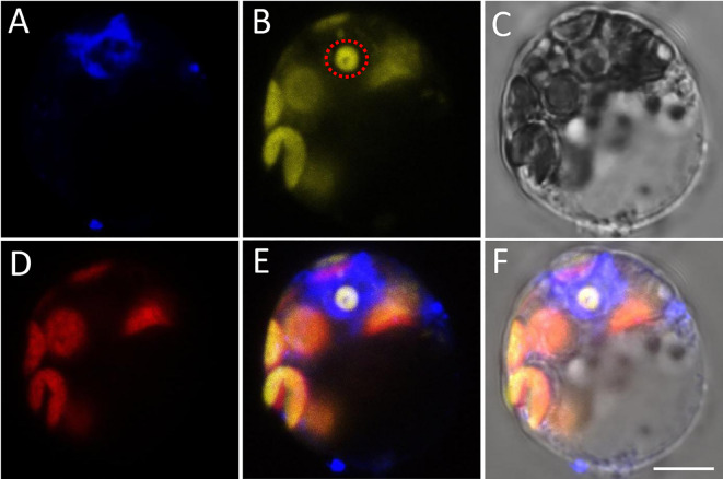 An optimum study on the laser scanning confocal microscopy techniques for BiFC assay using plant protoplast.