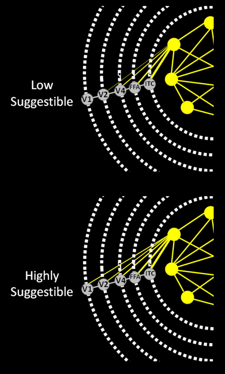 A global neuronal workspace model of functional neurological disorders.