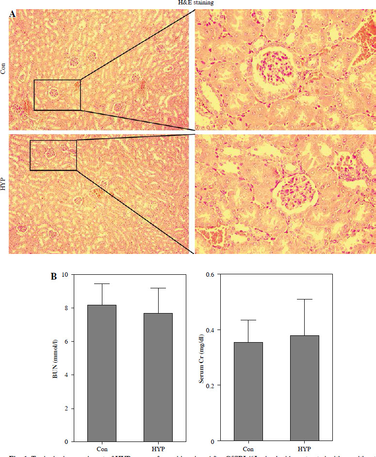 Preventive effect of hyperforin on lipopolysaccharide-induced acute kidney injury and inflammation by repressing the NF-κB/miR-21 axis.