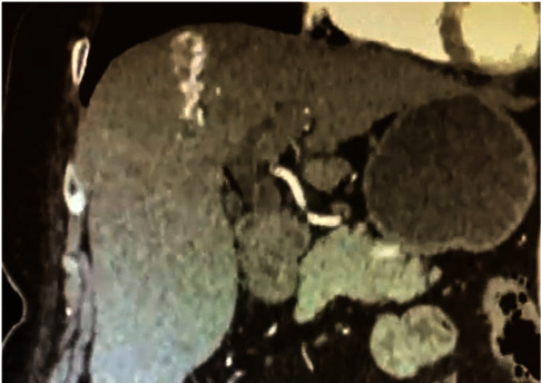 Abstract Image