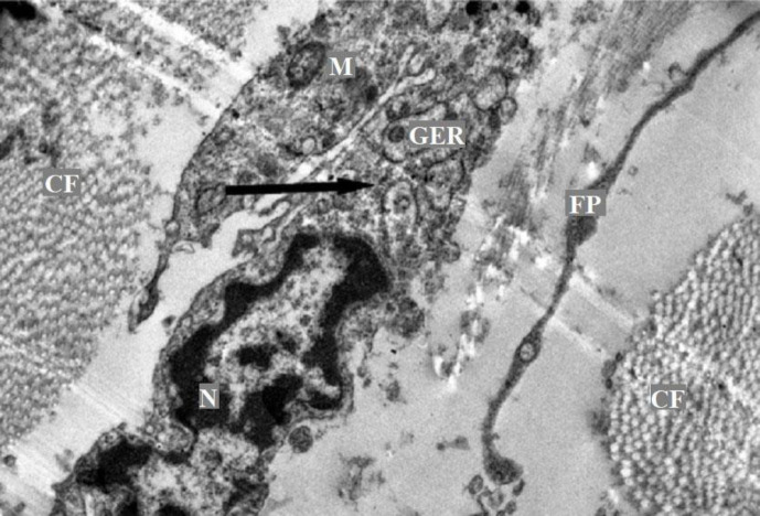 Ultra-structural organization of the gallbladder mucous membrane of Anglo-Nubian goat.