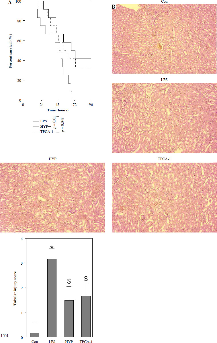 Preventive effect of hyperforin on lipopolysaccharide-induced acute kidney injury and inflammation by repressing the NF-κB/miR-21 axis.