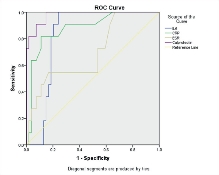 Role of Calprotectin, IL-6, and CRP in Distinguishing Between Inflammatory Bowel Disease and Diarrhea Predominant Irritable Bowel Syndrome.