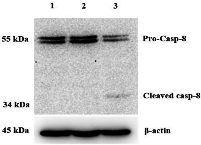 Potential Otubain1 Inhibitor, an Approach for a Treatment against Breast Cancer.