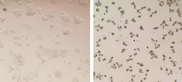 Potential Otubain1 Inhibitor, an Approach for a Treatment against Breast Cancer.