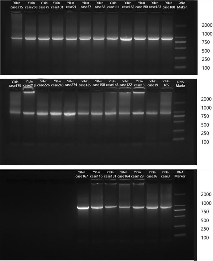 Respiratory virus infections and adenovirus characteristics during acute exacerbation of chronic obstructive pulmonary disease.