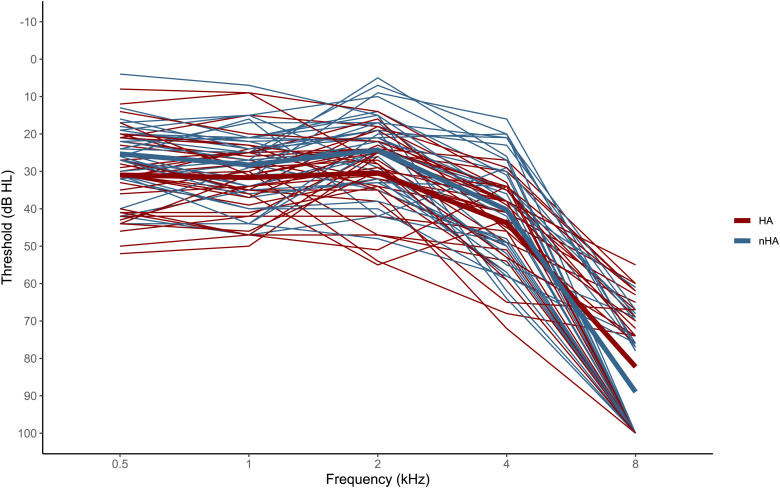 Processing of Visual Speech Cues in Speech-in-Noise Comprehension Depends on Working Memory Capacity and Enhances Neural Speech Tracking in Older Adults With Hearing Impairment.