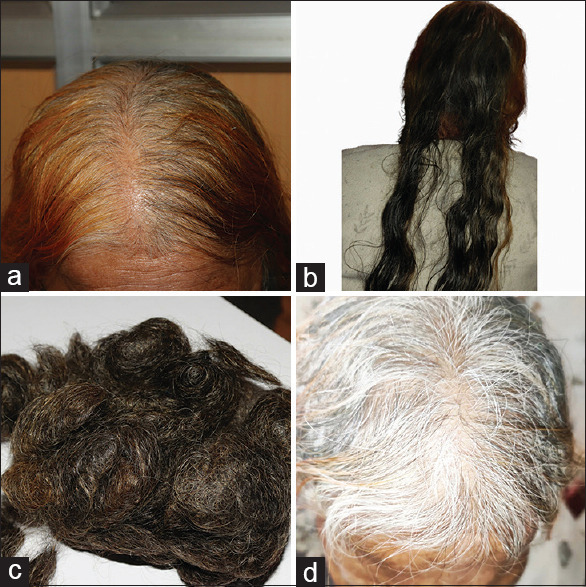 Don't Judge When the Tresses Fall.